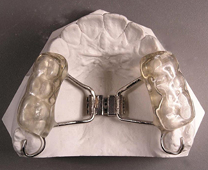 charm Lab Structurally Ortodonție - Aparat dentar safir, WIN, INVISALIGN, INCOGNITO